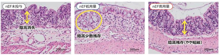 nEF投与量別の結腸の写真