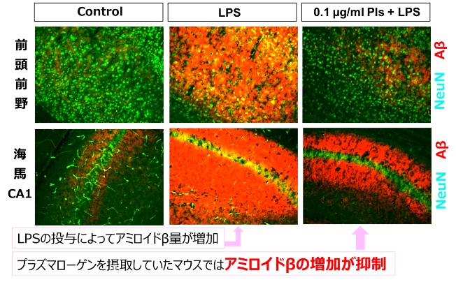 アミロイドβの蓄積抑制