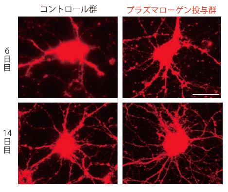 プラズマローゲン投与群はコントロール群よりも細胞の樹状突起が増加していることがわかる